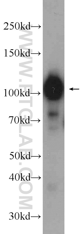 Western Blot (WB) analysis of mouse brain tissue using GPRIN1 Polyclonal antibody (13771-1-AP)