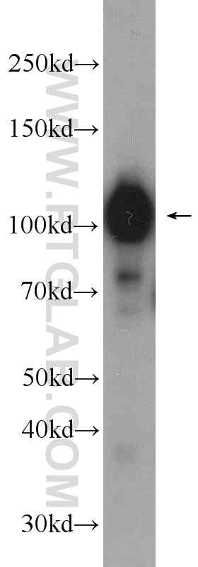 WB analysis of mouse brain using 13771-1-AP