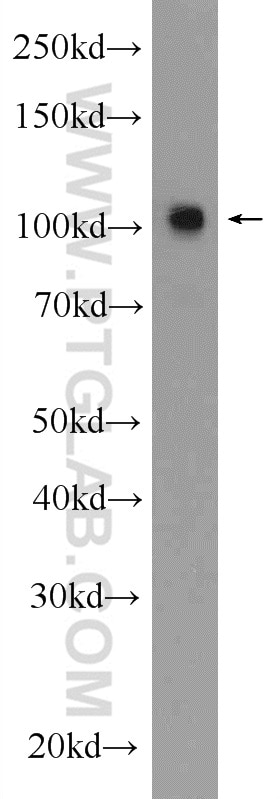 WB analysis of mouse brain using 13771-1-AP