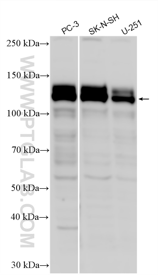 Various lysates were subjected to SDS PAGE followed by western blot with 13771-1-AP (GPRIN1 antibody) at dilution of 1:3000 incubated at room temperature for 1.5 hours. Western Blot (WB) analysis of various lysates using GPRIN1 Polyclonal antibody (13771-1-AP)
