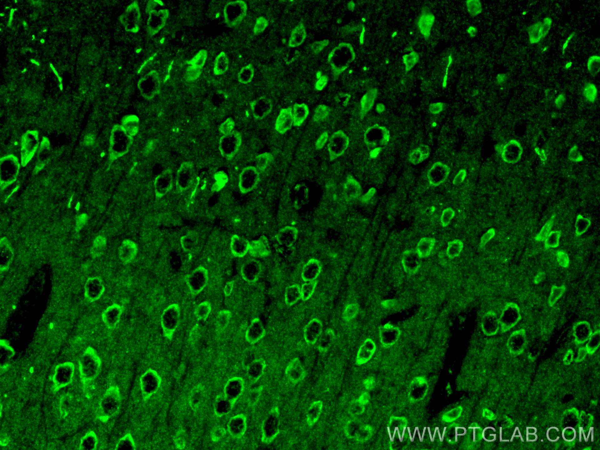 Immunofluorescence (IF) / fluorescent staining of mouse brain tissue using NMDAR1 Polyclonal antibody (27676-1-AP)