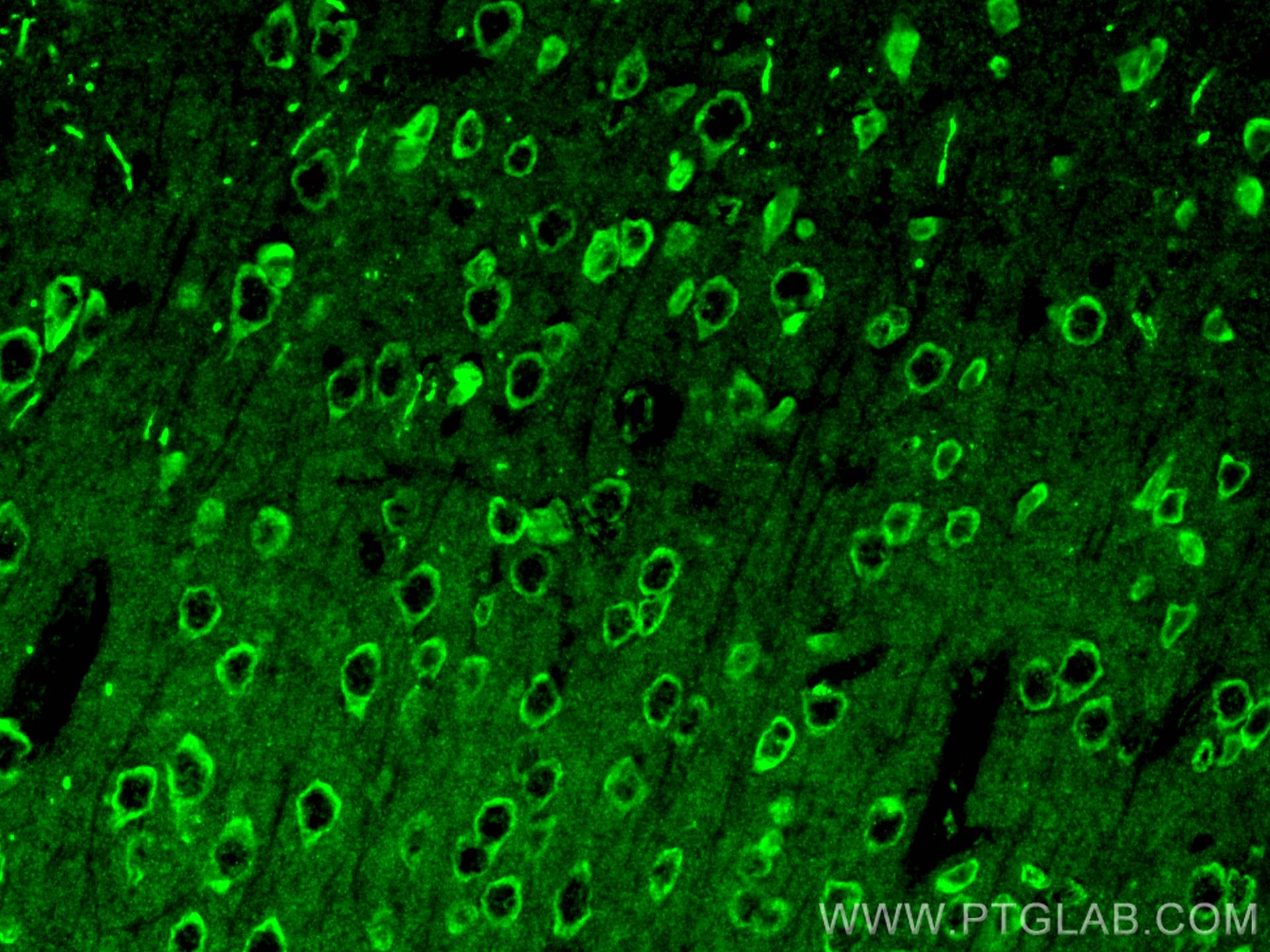 Immunofluorescence (IF) / fluorescent staining of mouse brain tissue using NMDAR1/GRIN1 Polyclonal antibody (27676-1-AP)