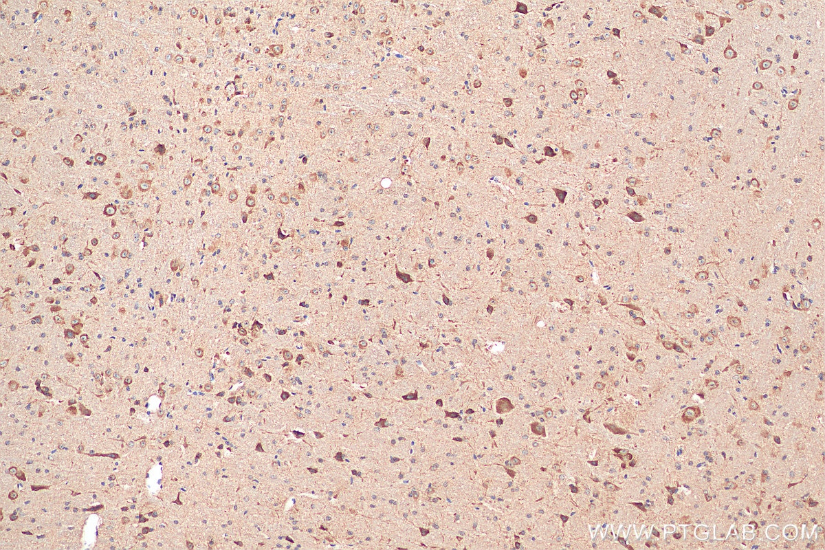 Immunohistochemistry (IHC) staining of mouse cerebellum tissue using NMDAR1/GRIN1 Polyclonal antibody (27676-1-AP)