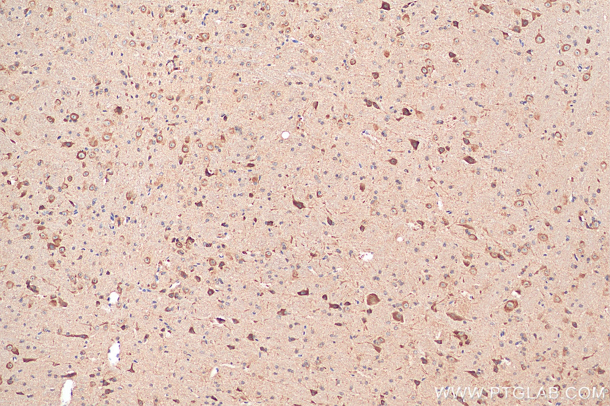 IHC staining of mouse cerebellum using 27676-1-AP