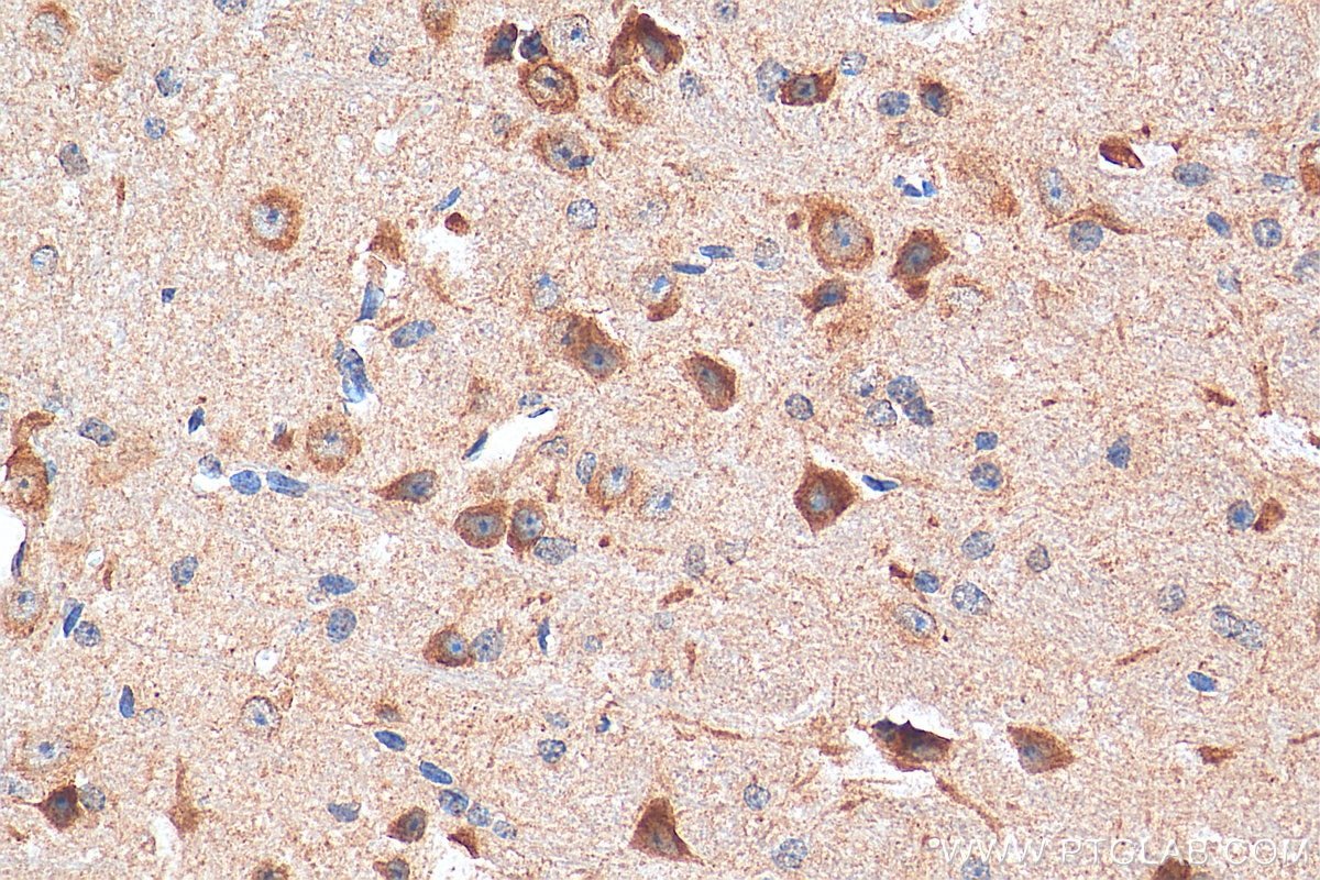 IHC staining of mouse cerebellum using 27676-1-AP