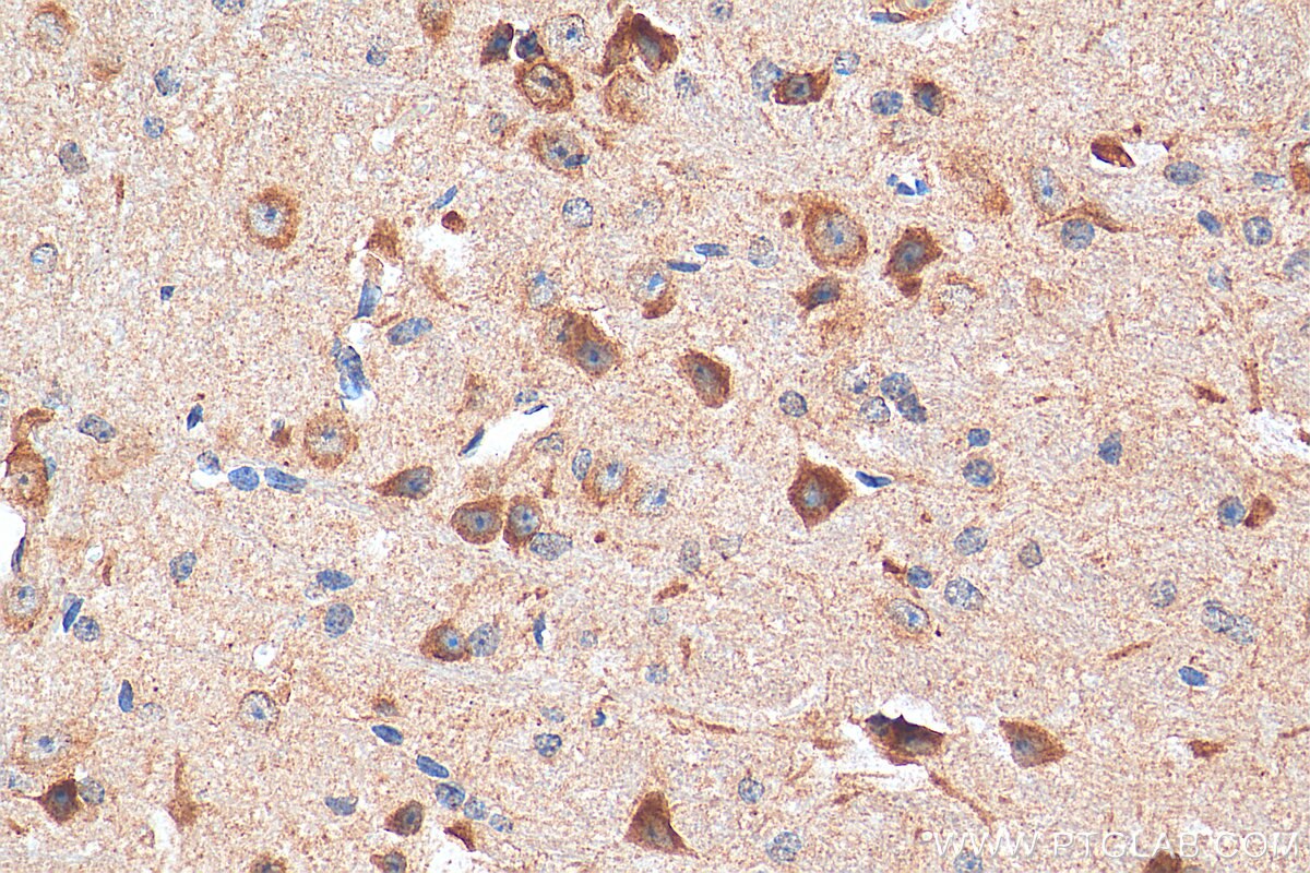 Immunohistochemistry (IHC) staining of mouse cerebellum tissue using NMDAR1/GRIN1 Polyclonal antibody (27676-1-AP)