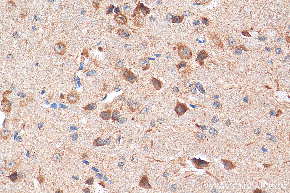 Immunohistochemistry (IHC) staining of mouse cerebellum tissue using NMDAR1 Polyclonal antibody (27676-1-AP)