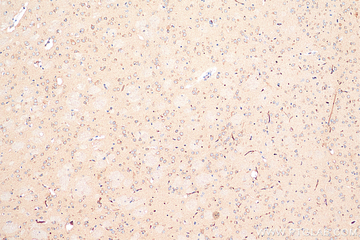 Immunohistochemistry (IHC) staining of mouse brain tissue using NMDAR1 Polyclonal antibody (27676-1-AP)