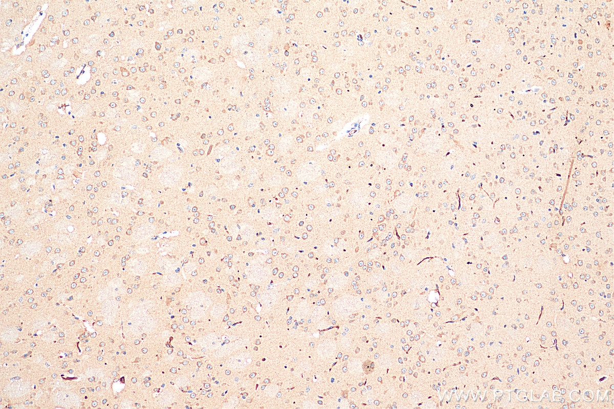Immunohistochemistry (IHC) staining of mouse brain tissue using NMDAR1/GRIN1 Polyclonal antibody (27676-1-AP)
