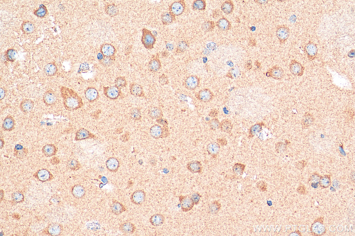 Immunohistochemistry (IHC) staining of mouse brain tissue using NMDAR1 Polyclonal antibody (27676-1-AP)