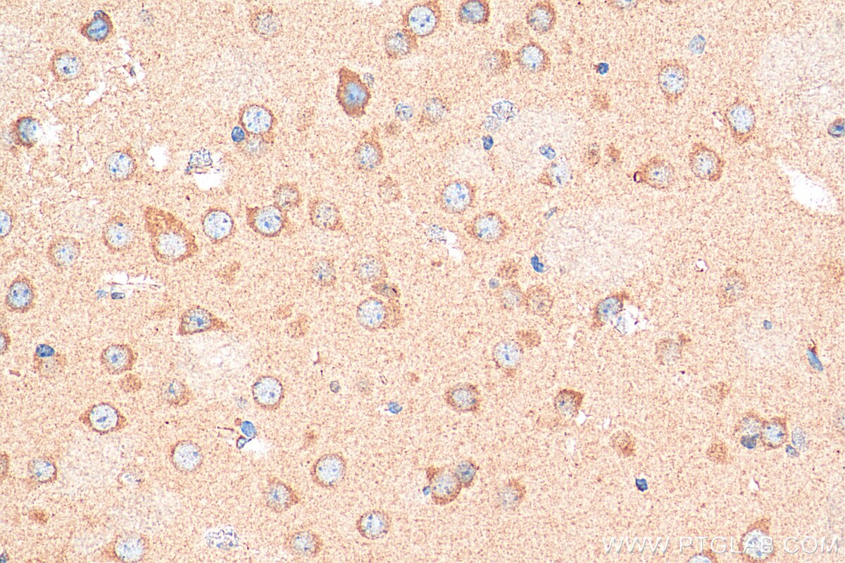 Immunohistochemistry (IHC) staining of mouse brain tissue using NMDAR1/GRIN1 Polyclonal antibody (27676-1-AP)