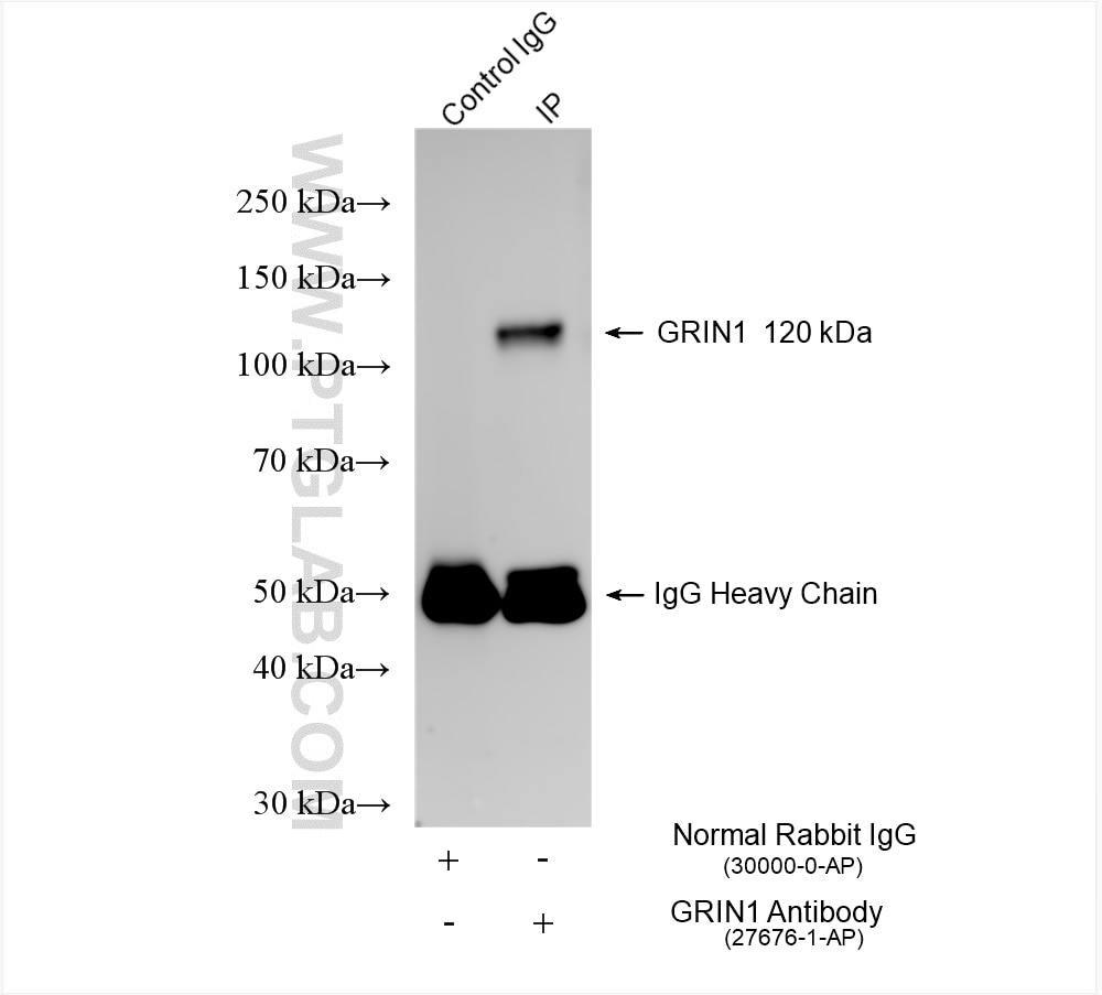 Immunoprecipitation (IP) experiment of mouse brain tissue using NMDAR1/GRIN1 Polyclonal antibody (27676-1-AP)