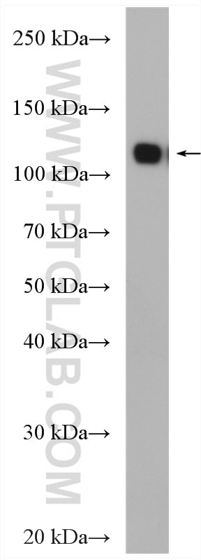 Western Blot (WB) analysis of mouse brain tissue using NMDAR1/GRIN1 Polyclonal antibody (27676-1-AP)