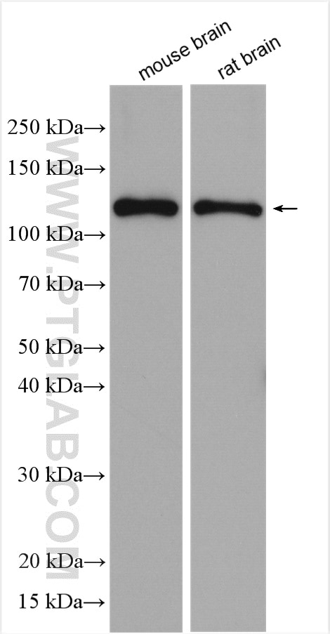 Western Blot (WB) analysis of various lysates using NMDAR1/GRIN1 Polyclonal antibody (27676-1-AP)