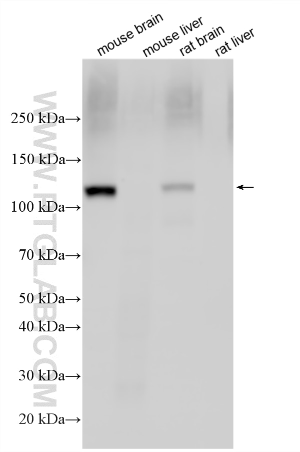 Western Blot (WB) analysis of various lysates using NMDAR1/GRIN1 Polyclonal antibody (27676-1-AP)