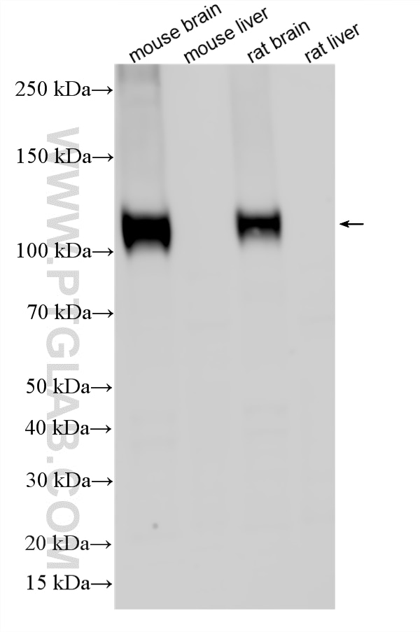 Western Blot (WB) analysis of various lysates using NMDAR1/GRIN1 Polyclonal antibody (27676-1-AP)