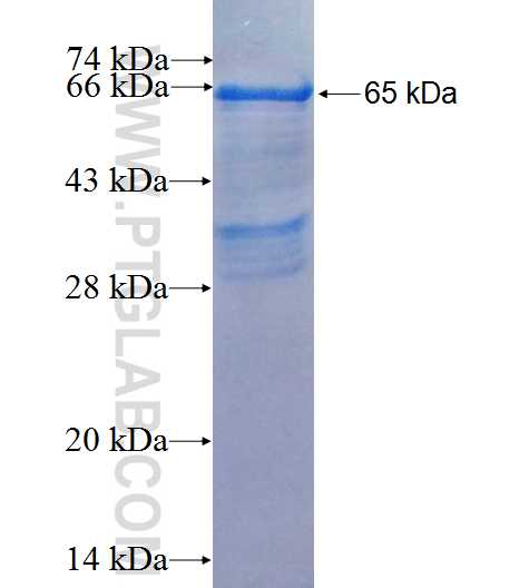 GRIN1 fusion protein Ag4754 SDS-PAGE