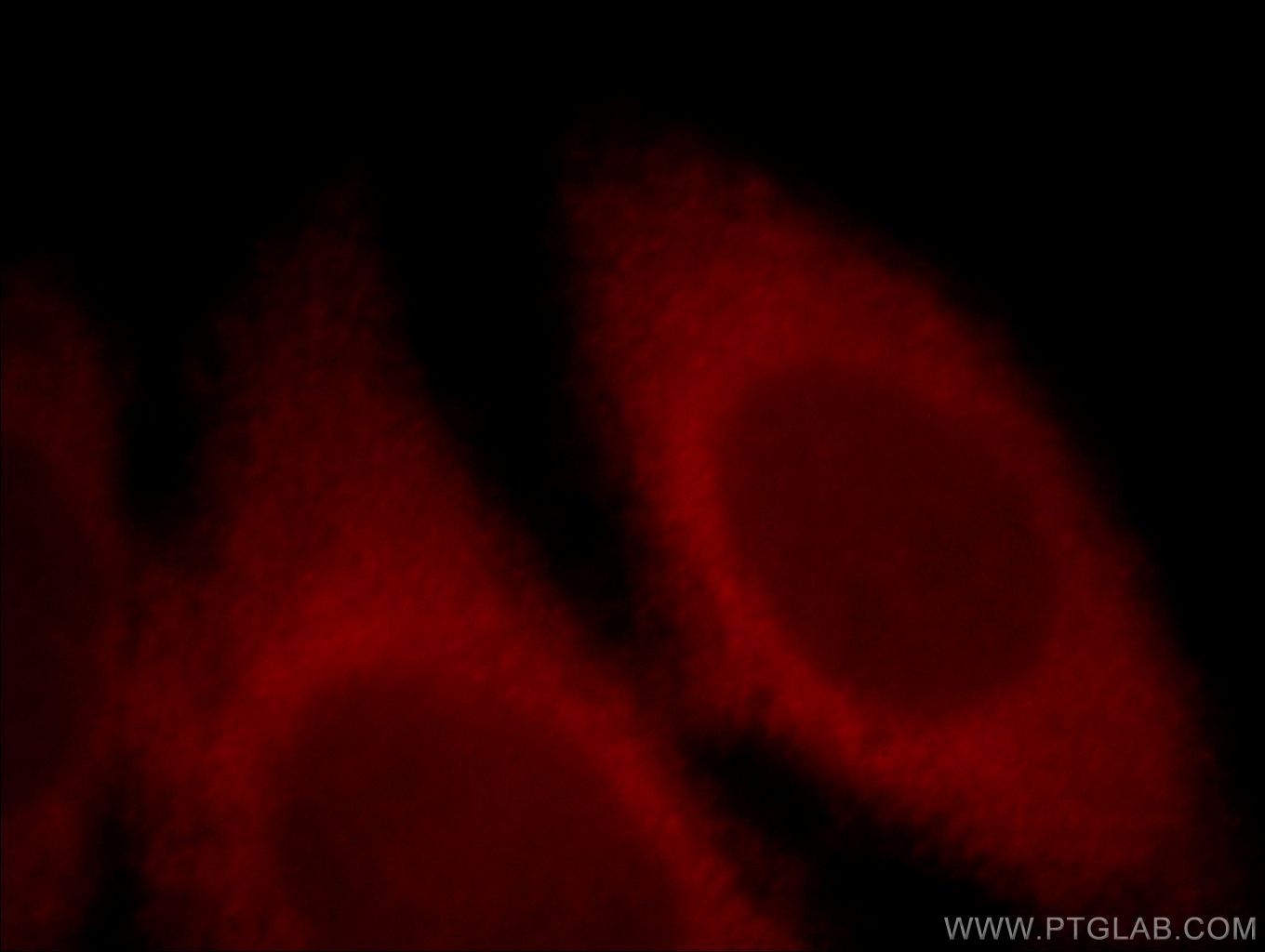 Immunofluorescence (IF) / fluorescent staining of HeLa cells using NMDAR2A/GRIN2A Polyclonal antibody (19953-1-AP)