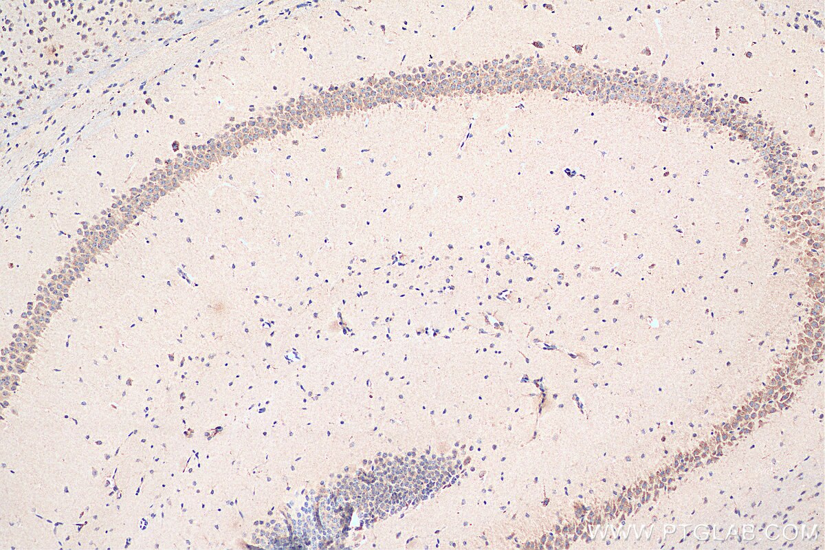 Immunohistochemistry (IHC) staining of mouse brain tissue using NMDAR2A/GRIN2A Polyclonal antibody (19953-1-AP)