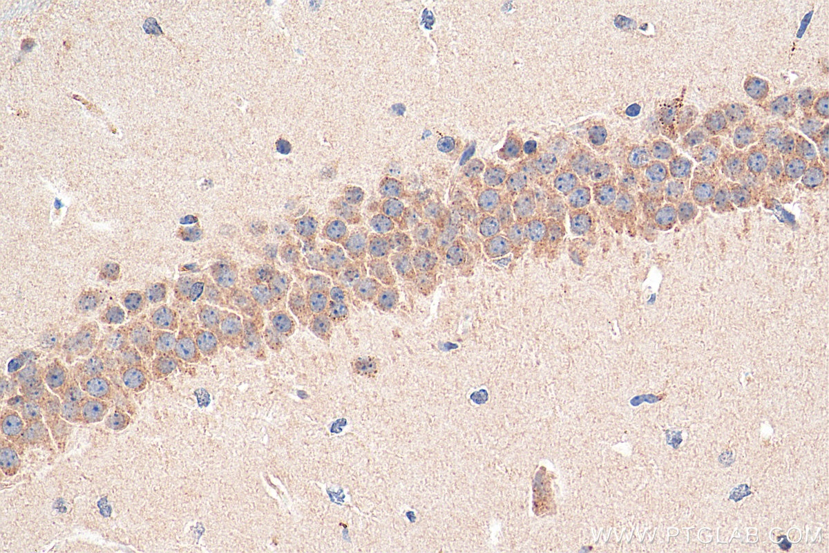 Immunohistochemistry (IHC) staining of mouse brain tissue using NMDAR2A/GRIN2A Polyclonal antibody (19953-1-AP)