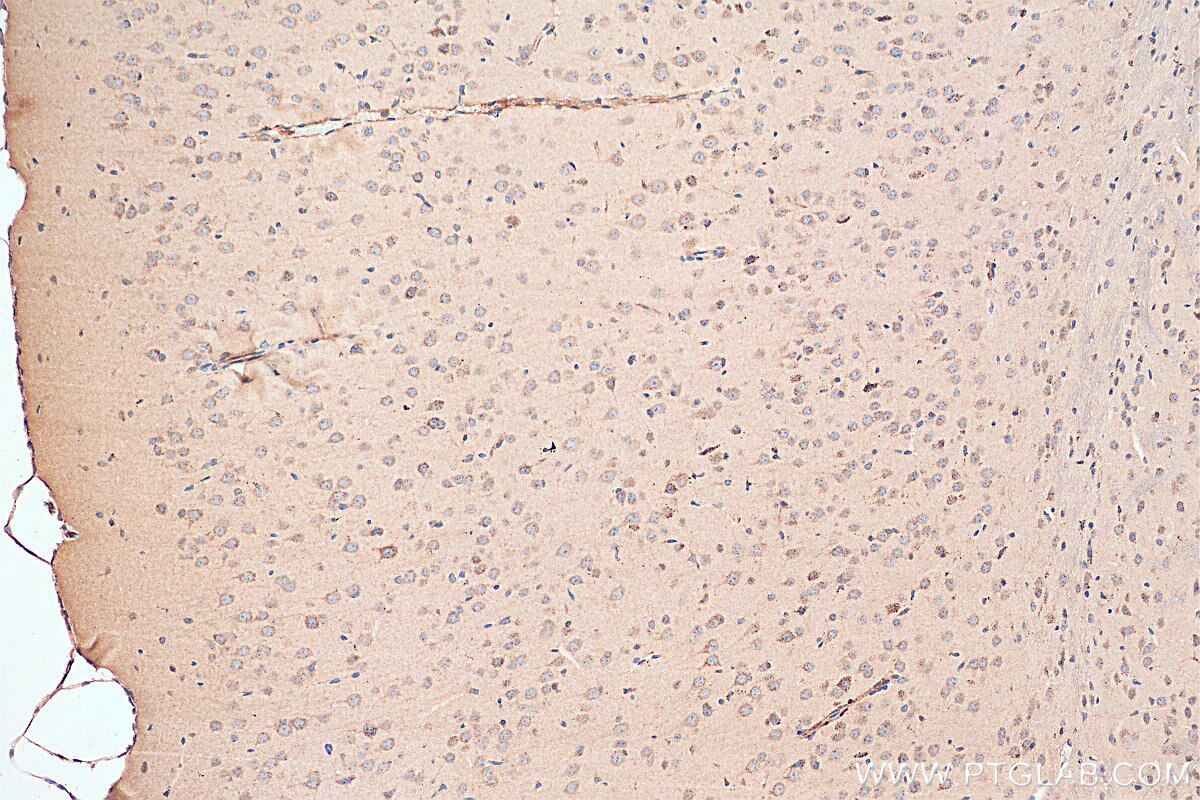 Immunohistochemistry (IHC) staining of mouse brain tissue using NMDAR2A/GRIN2A Polyclonal antibody (19953-1-AP)