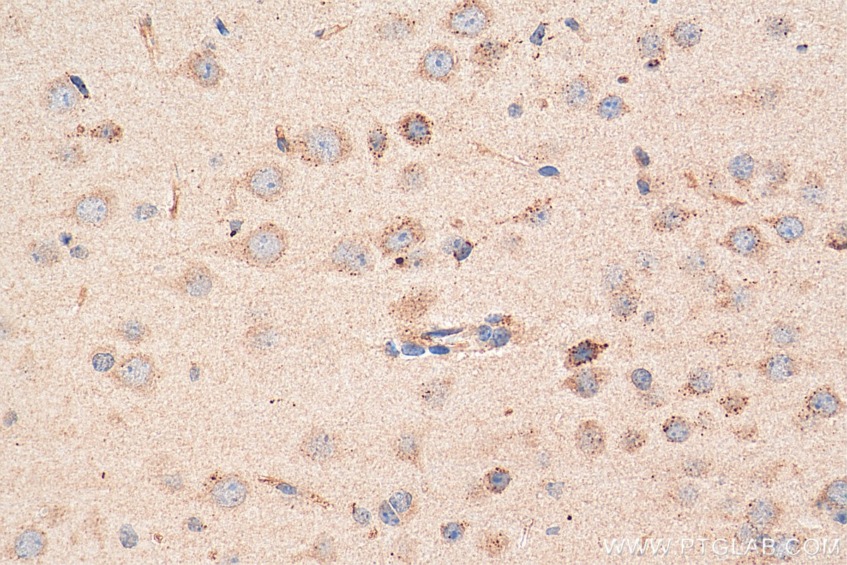 Immunohistochemistry (IHC) staining of mouse brain tissue using NMDAR2A/GRIN2A Polyclonal antibody (19953-1-AP)