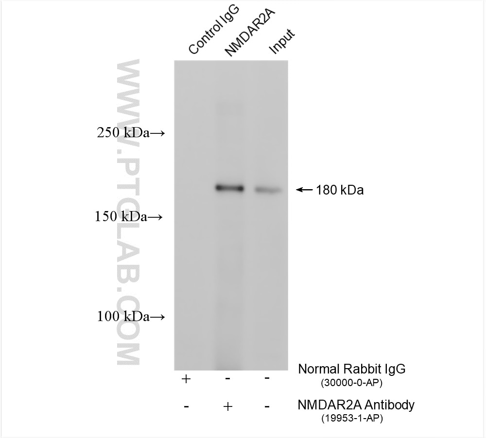 Immunoprecipitation (IP) experiment of mouse brain tissue using NMDAR2A/GRIN2A Polyclonal antibody (19953-1-AP)