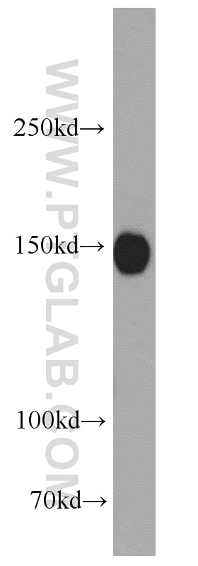 Western Blot (WB) analysis of mouse brain tissue using NMDAR2A/GRIN2A Polyclonal antibody (19953-1-AP)