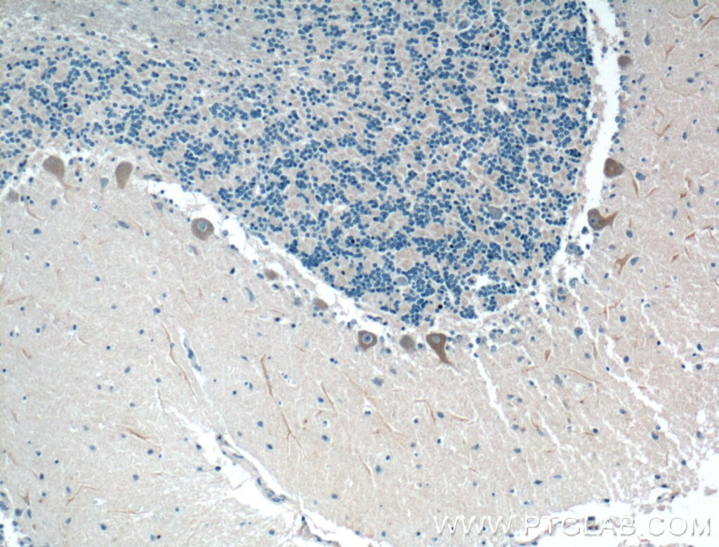 NMDAR2B/GRIN2B Polyclonal antibody