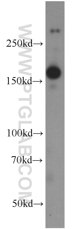 NMDAR2B/GRIN2B Polyclonal antibody