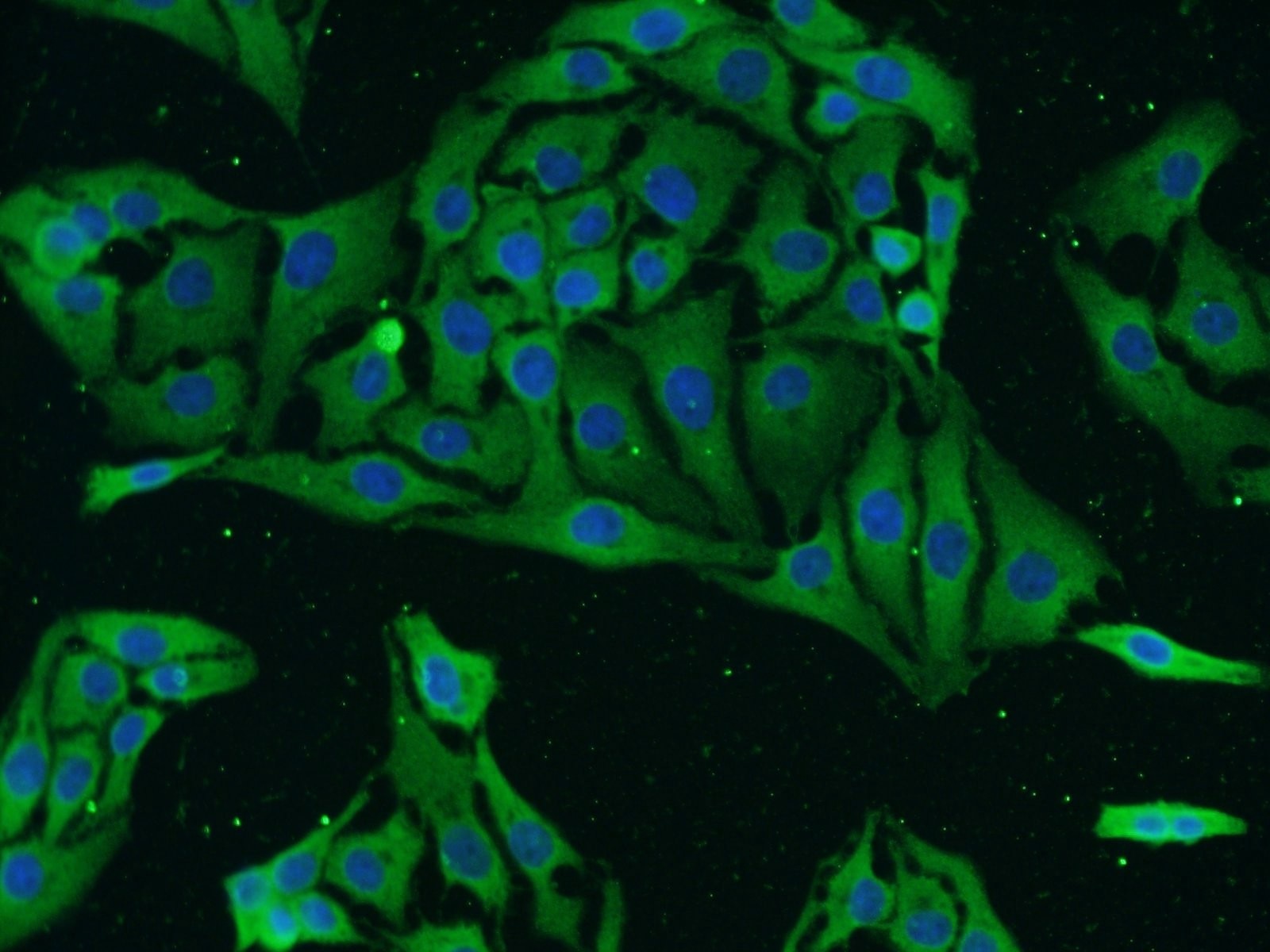 Immunofluorescence (IF) / fluorescent staining of SH-SY5Y cells using NMDAR2B/GRIN2B Polyclonal antibody (21920-1-AP)