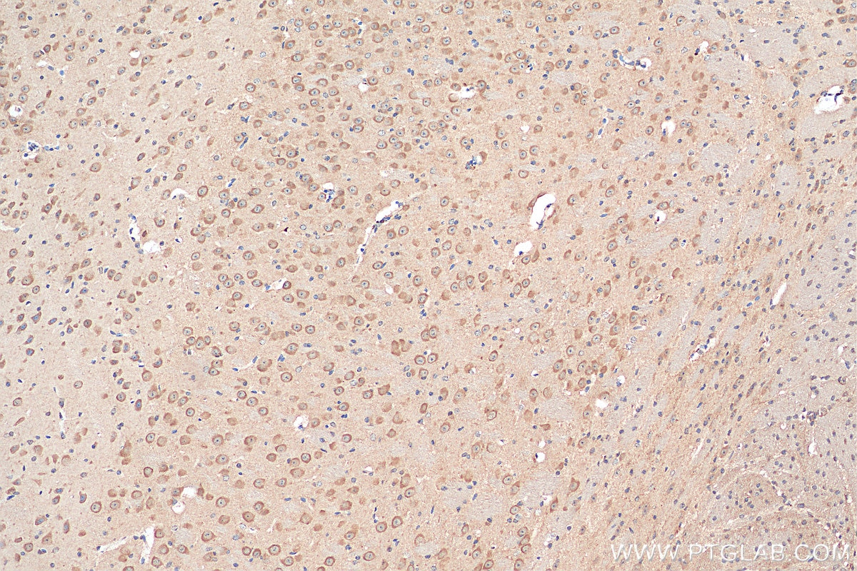 Immunohistochemistry (IHC) staining of mouse brain tissue using NMDAR2B/GRIN2B Polyclonal antibody (21920-1-AP)