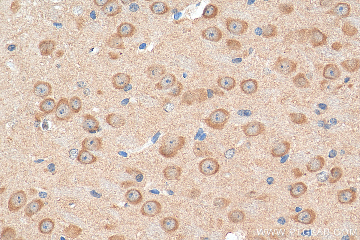 Immunohistochemistry (IHC) staining of mouse brain tissue using NMDAR2B/GRIN2B Polyclonal antibody (21920-1-AP)