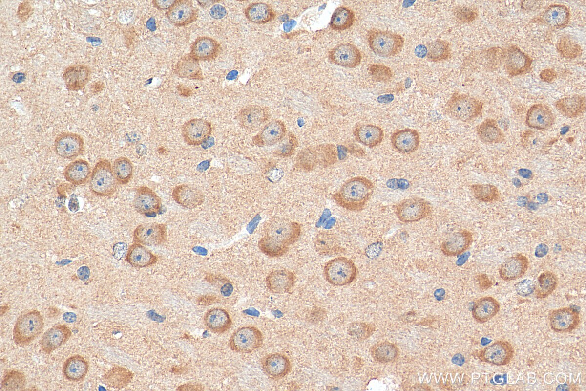 Immunohistochemistry (IHC) staining of mouse brain tissue using NMDAR2B/GRIN2B Polyclonal antibody (21920-1-AP)