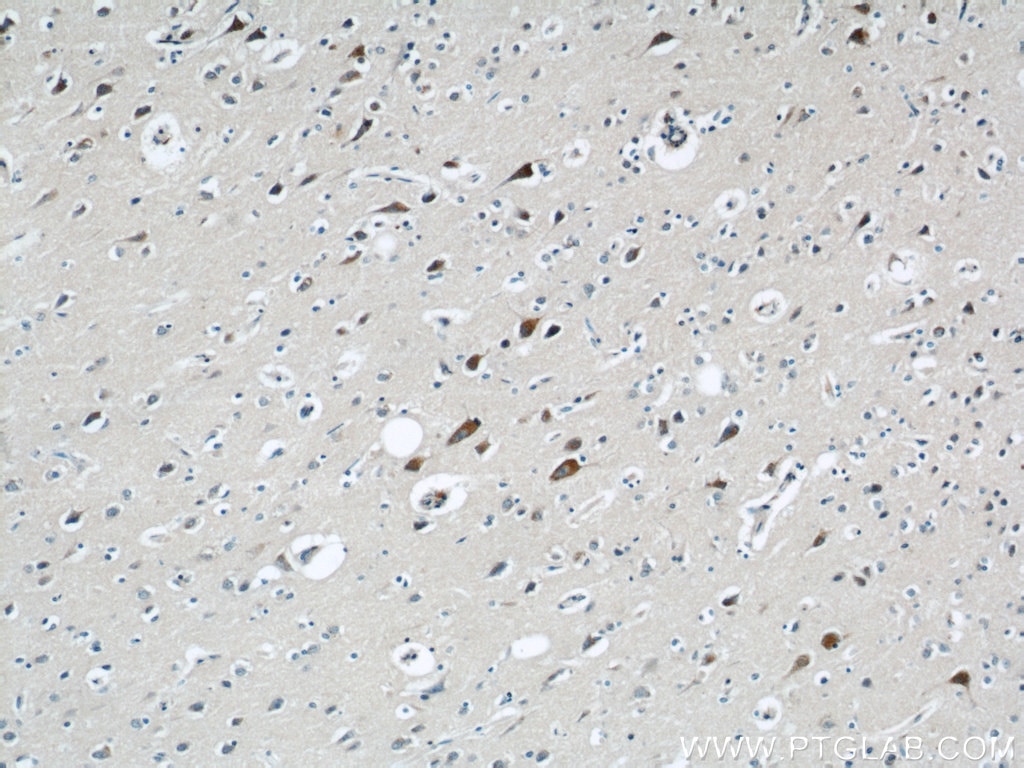 Immunohistochemistry (IHC) staining of human brain tissue using NMDAR2B/GRIN2B Polyclonal antibody (21920-1-AP)