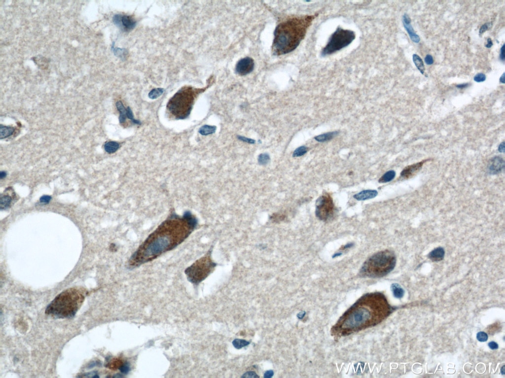 Immunohistochemistry (IHC) staining of human brain tissue using NMDAR2B/GRIN2B Polyclonal antibody (21920-1-AP)