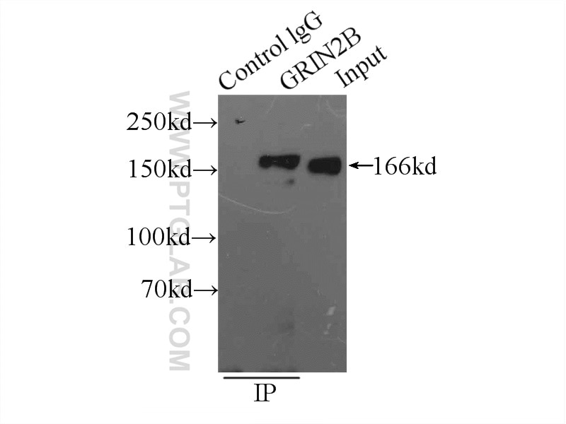 Immunoprecipitation (IP) experiment of mouse brain tissue using NMDAR2B/GRIN2B Polyclonal antibody (21920-1-AP)