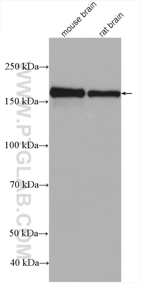 Western Blot (WB) analysis of various lysates using NMDAR2B/GRIN2B Polyclonal antibody (21920-1-AP)