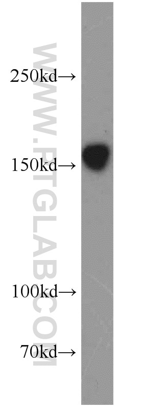 Western Blot (WB) analysis of human brain tissue using NMDAR2B/GRIN2B Polyclonal antibody (21920-1-AP)