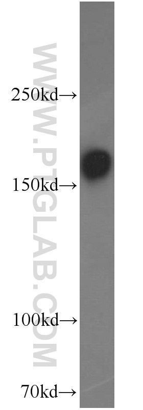 NMDAR2B/GRIN2B Polyclonal antibody
