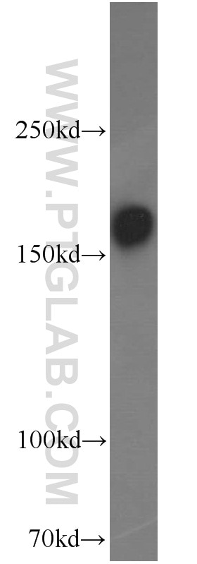 Western Blot (WB) analysis of mouse brain tissue using NMDAR2B/GRIN2B Polyclonal antibody (21920-1-AP)