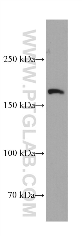 NMDAR2B/GRIN2B