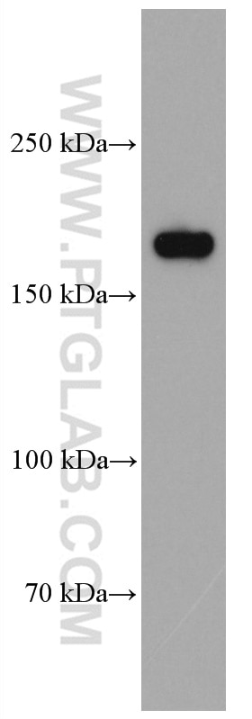 Western Blot (WB) analysis of rat brain tissue using NMDAR2B/GRIN2B Monoclonal antibody (66565-1-Ig)