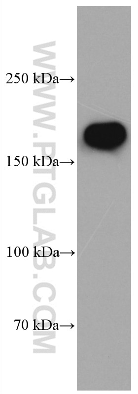 Western Blot (WB) analysis of mouse brain tissue using NMDAR2B/GRIN2B Monoclonal antibody (66565-1-Ig)