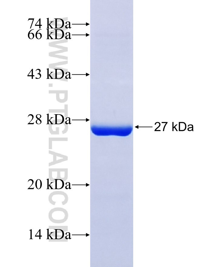 GRIN3B fusion protein Ag36124 SDS-PAGE GRIN3B fusion protein Ag36124 SDS-PAGE