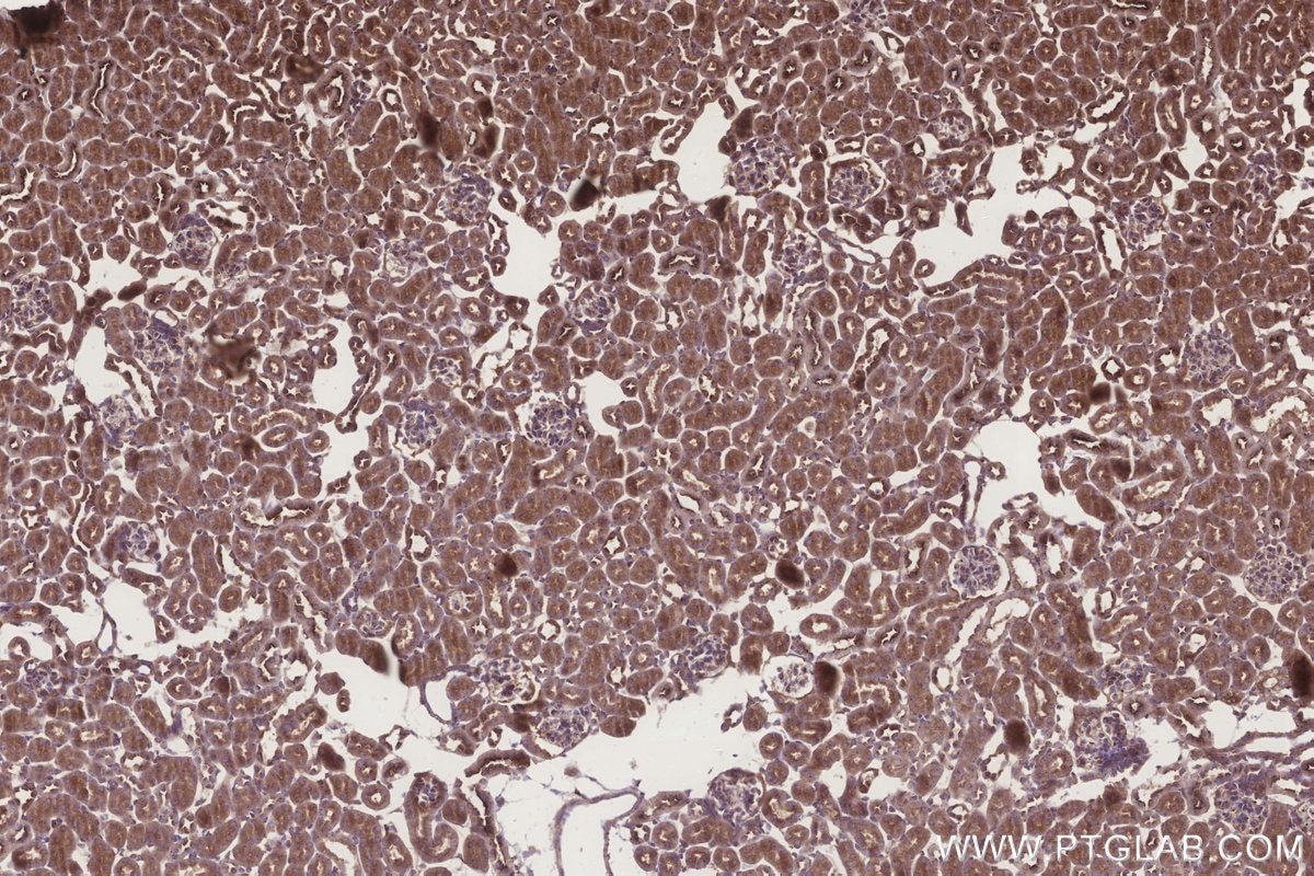 IHC staining of mouse kidney using 20851-1-AP Immunohistochemistry (IHC) staining of mouse kidney tissue using GRINA Polyclonal antibody (20851-1-AP)