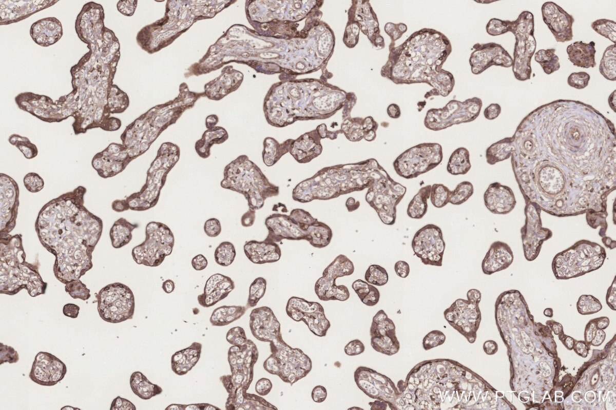 IHC staining of human placenta using 20851-1-AP Immunohistochemistry (IHC) staining of human placenta tissue using GRINA Polyclonal antibody (20851-1-AP)