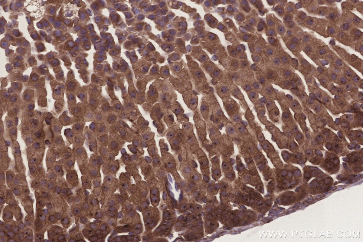 IHC staining of mouse adrenal gland using 20851-1-AP Immunohistochemistry (IHC) staining of mouse adrenal gland tissue using GRINA Polyclonal antibody (20851-1-AP)