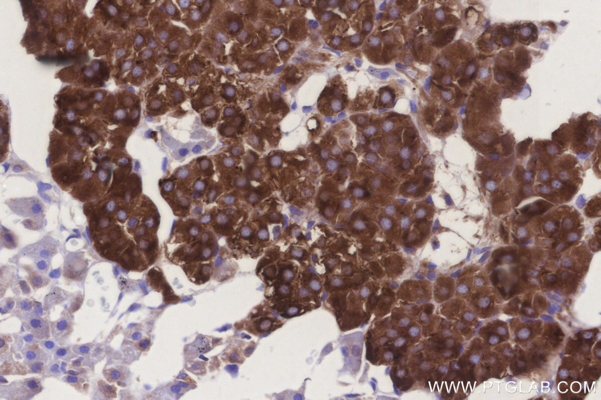 IHC staining of rat adrenal gland using 20851-1-AP Immunohistochemistry (IHC) staining of rat adrenal gland tissue using GRINA Polyclonal antibody (20851-1-AP)