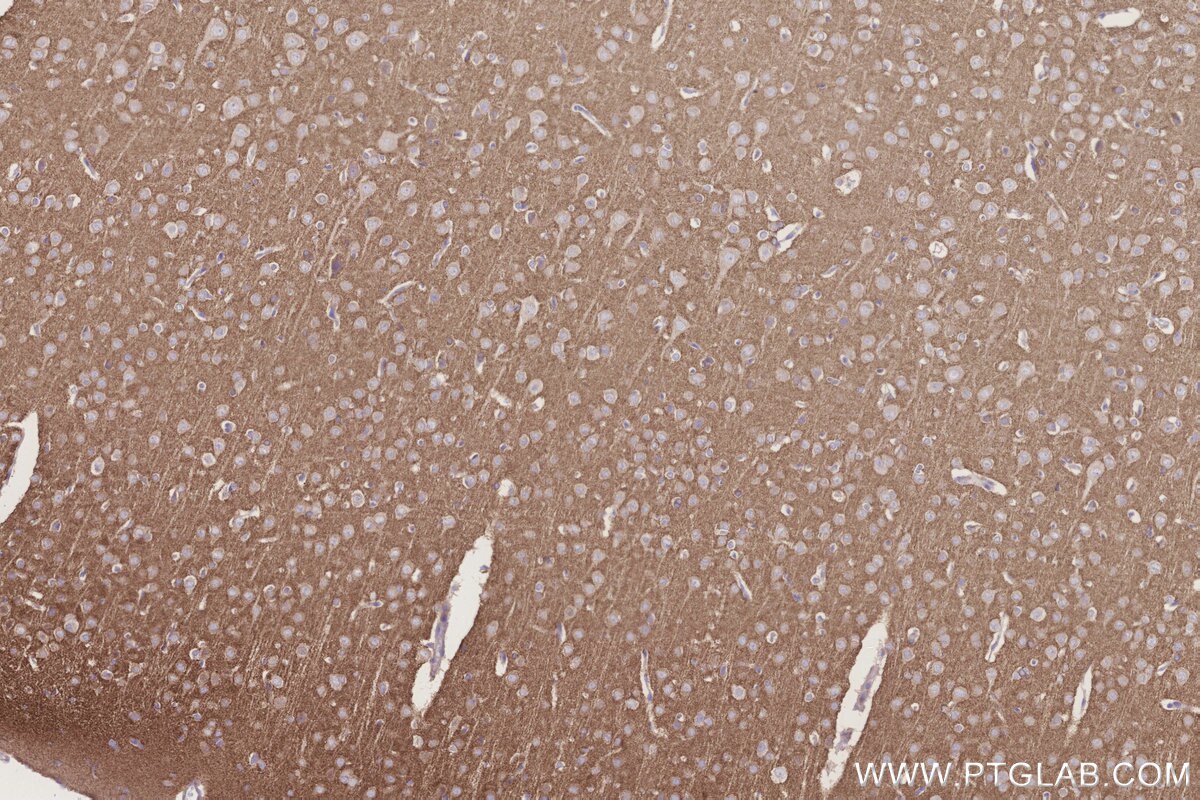 IHC staining of rat brain using 20851-1-AP Immunohistochemistry (IHC) staining of rat brain tissue using GRINA Polyclonal antibody (20851-1-AP)